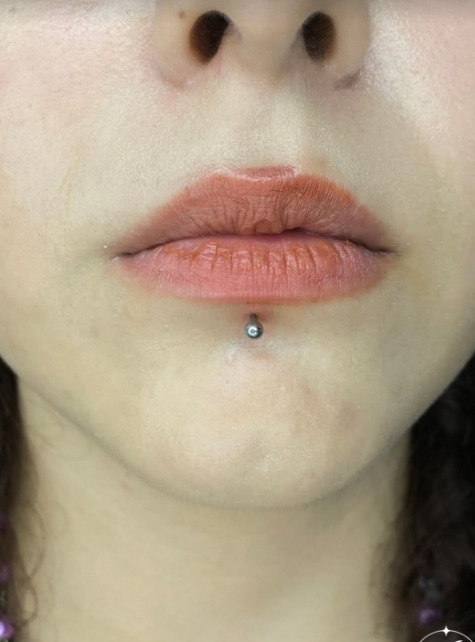 LABRET PİERSİNG